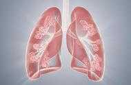 反覆感冒咳嗽，鼻子發乾發癢是肺的原因嗎？