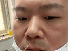 岳雲鵬因身體不適暫停工作，停工後首次露面，迴應手術已做完。